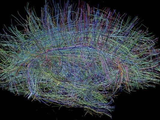 Artwork for Episode 68 – Moran Cerf Ph.D. – The Razor’s Edge of Neuroscience